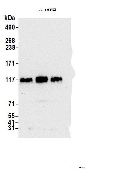 DDHD1 Antibody