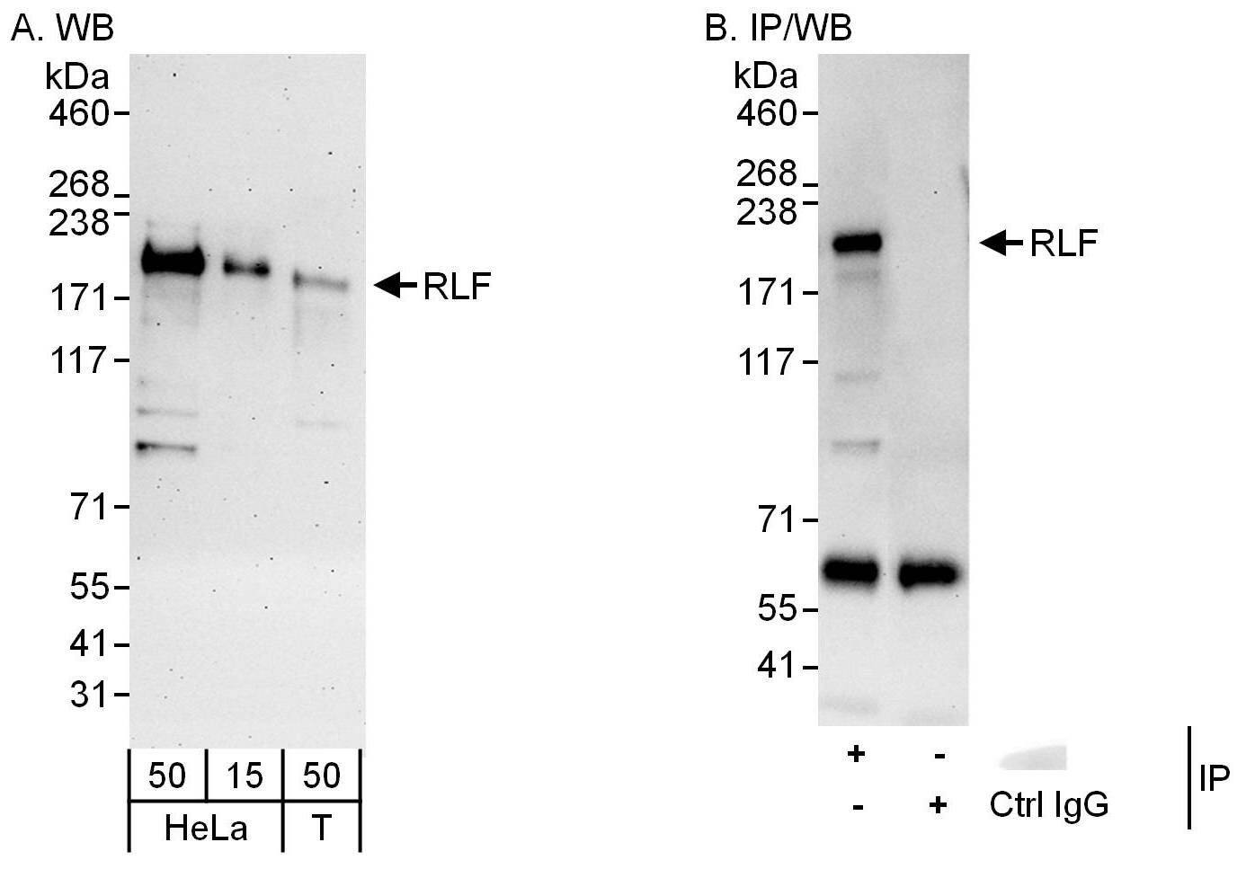 RLF Antibody