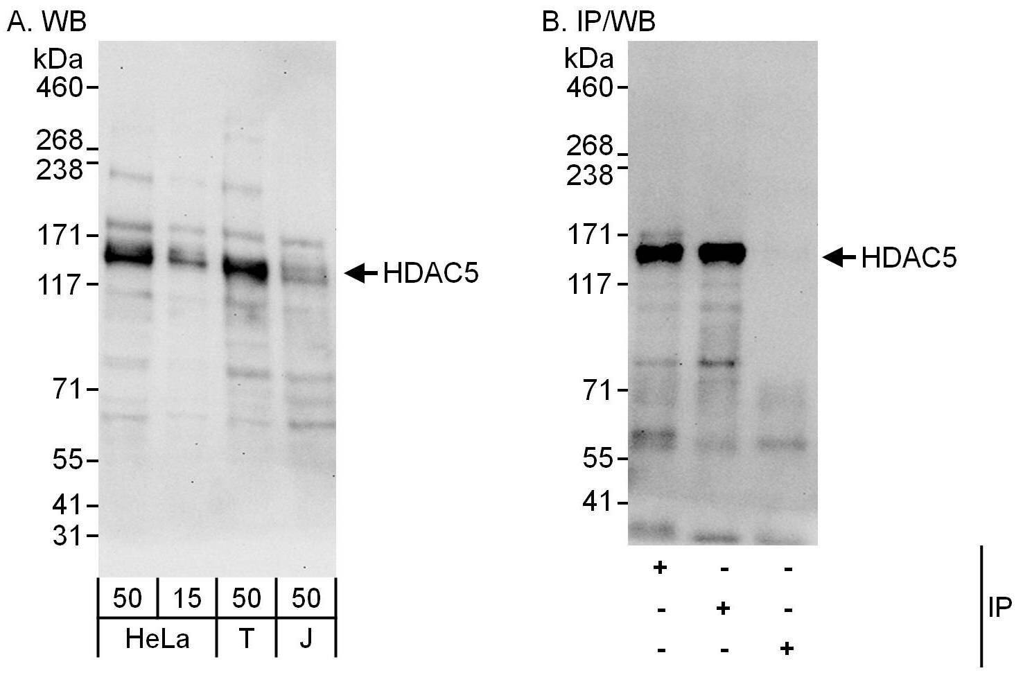 HDAC5 Antibody