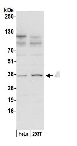 Dimethylarginine Dimethylaminohydrolase 1/DDAH1 Antibody