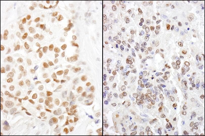 HMGN1/HMG14 Antibody