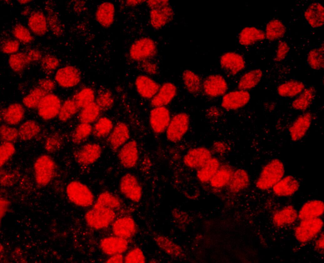 HMGN1/HMG14 Antibody