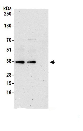 Apolipoprotein L2 Antibody