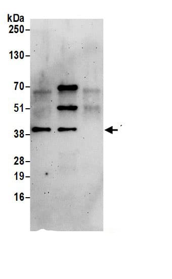 HSP40/DNAJB1 Antibody