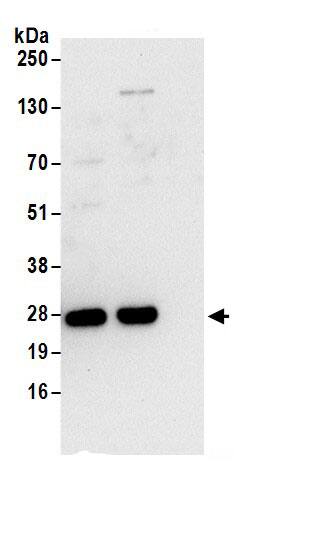 LSM12 Antibody