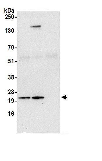 Synaptobrevin homolog YKT6 Antibody