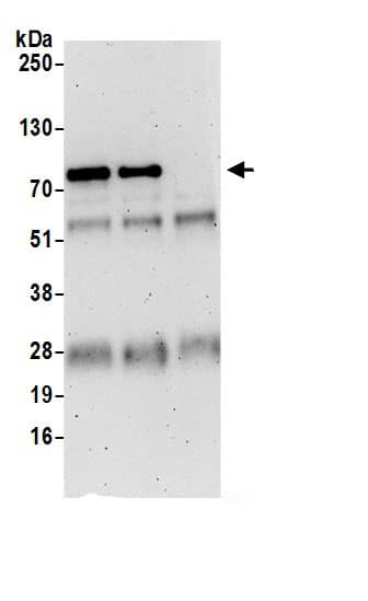 LZTS1 Antibody