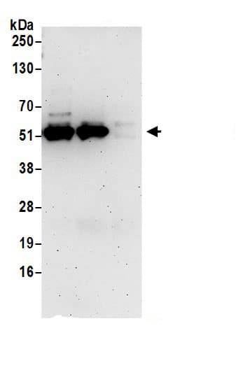 MPP1 Antibody