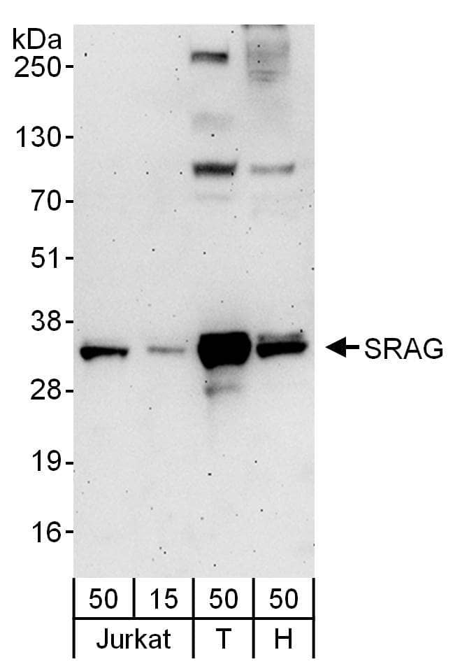 CHTOP Antibody