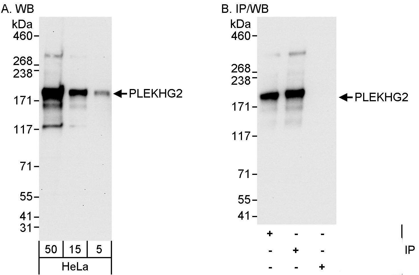 PLEKHG2 Antibody