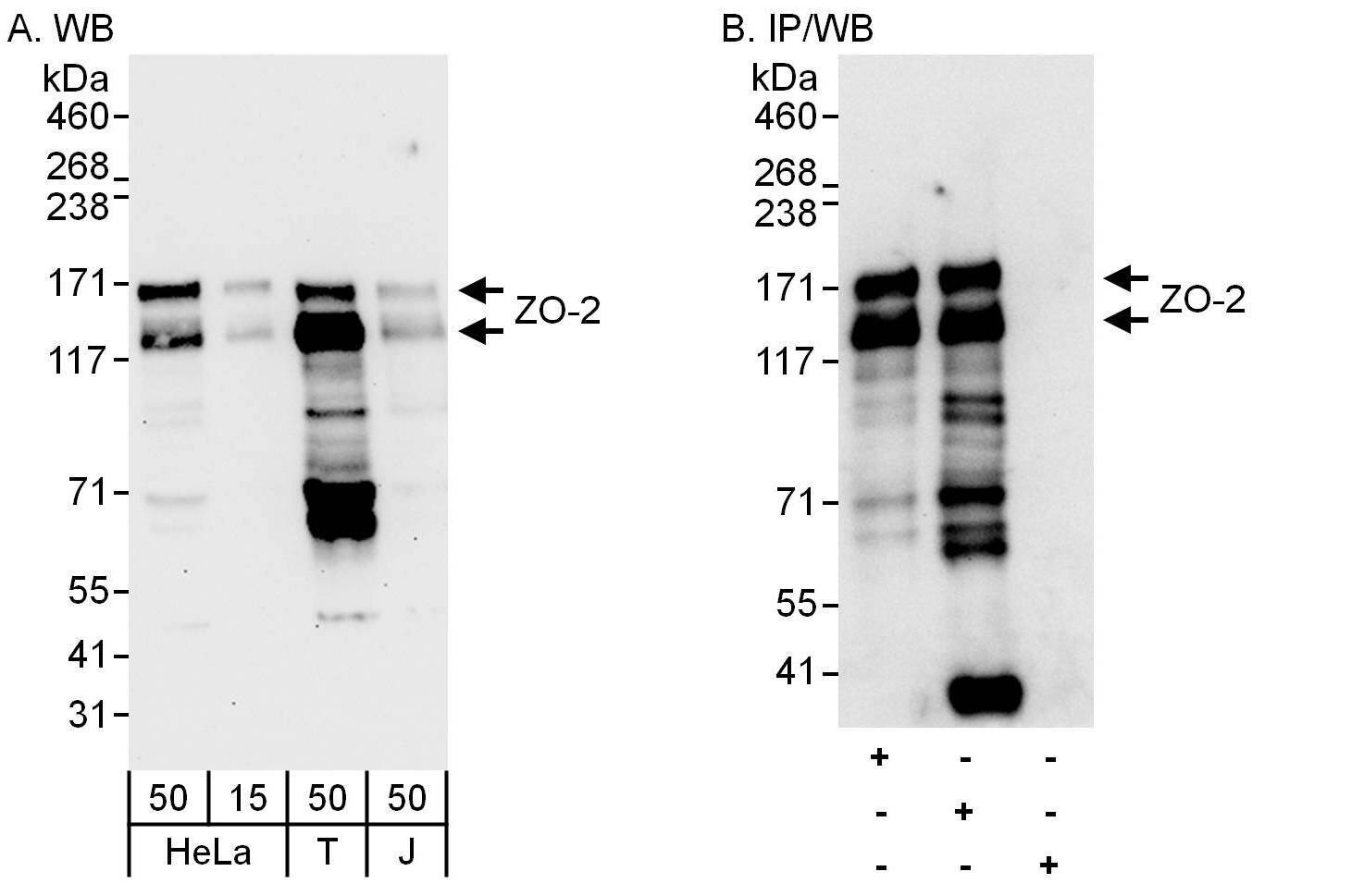 Tight Junction Protein 2 Antibody