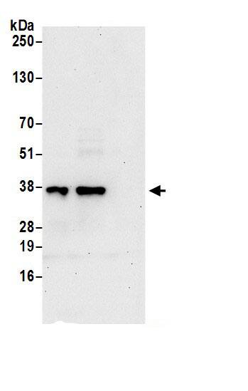 SUCLG1 Antibody