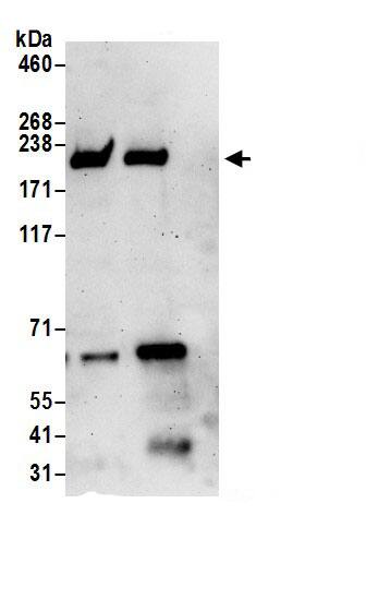 RhoGAP Antibody