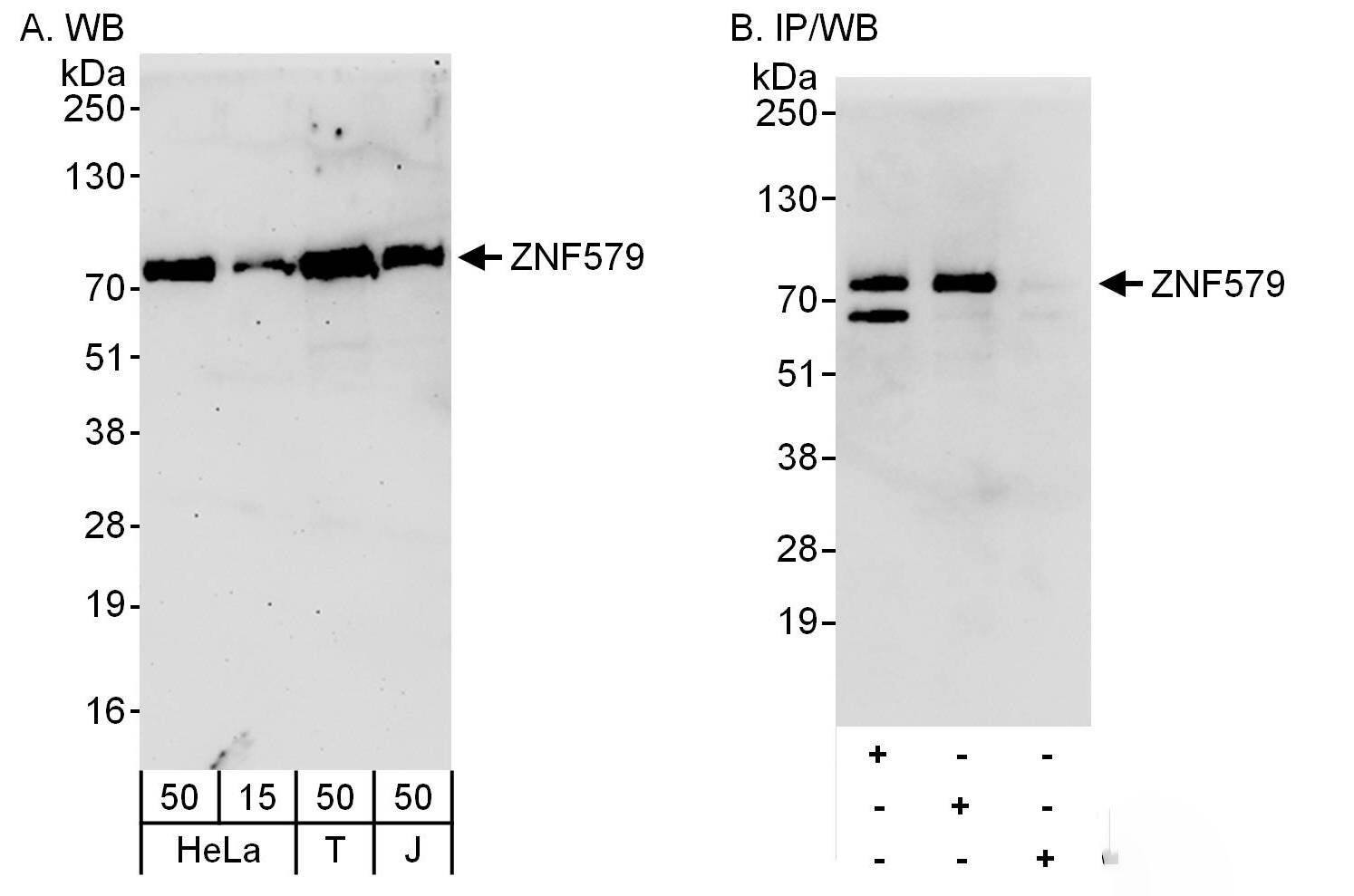 ZNF579 Antibody