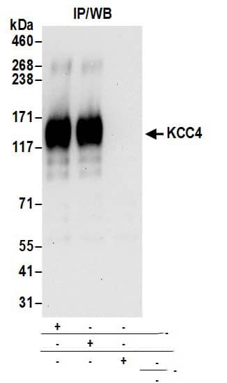 KCC4/SLC12A7 Antibody