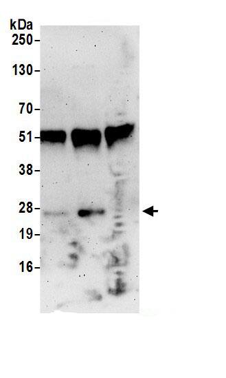 RPP25 Antibody