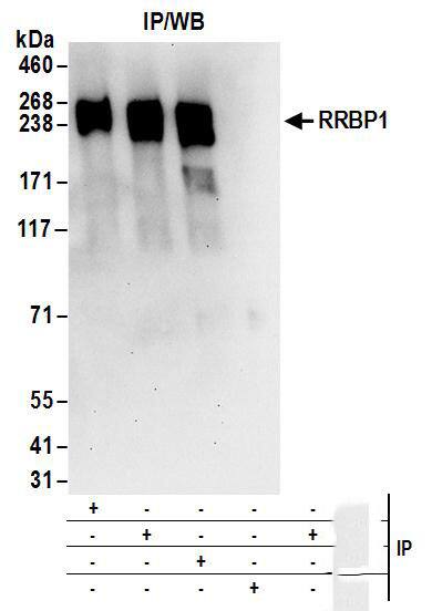 RRBP1 Antibody