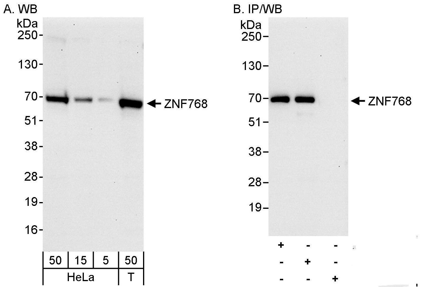 ZNF768 Antibody