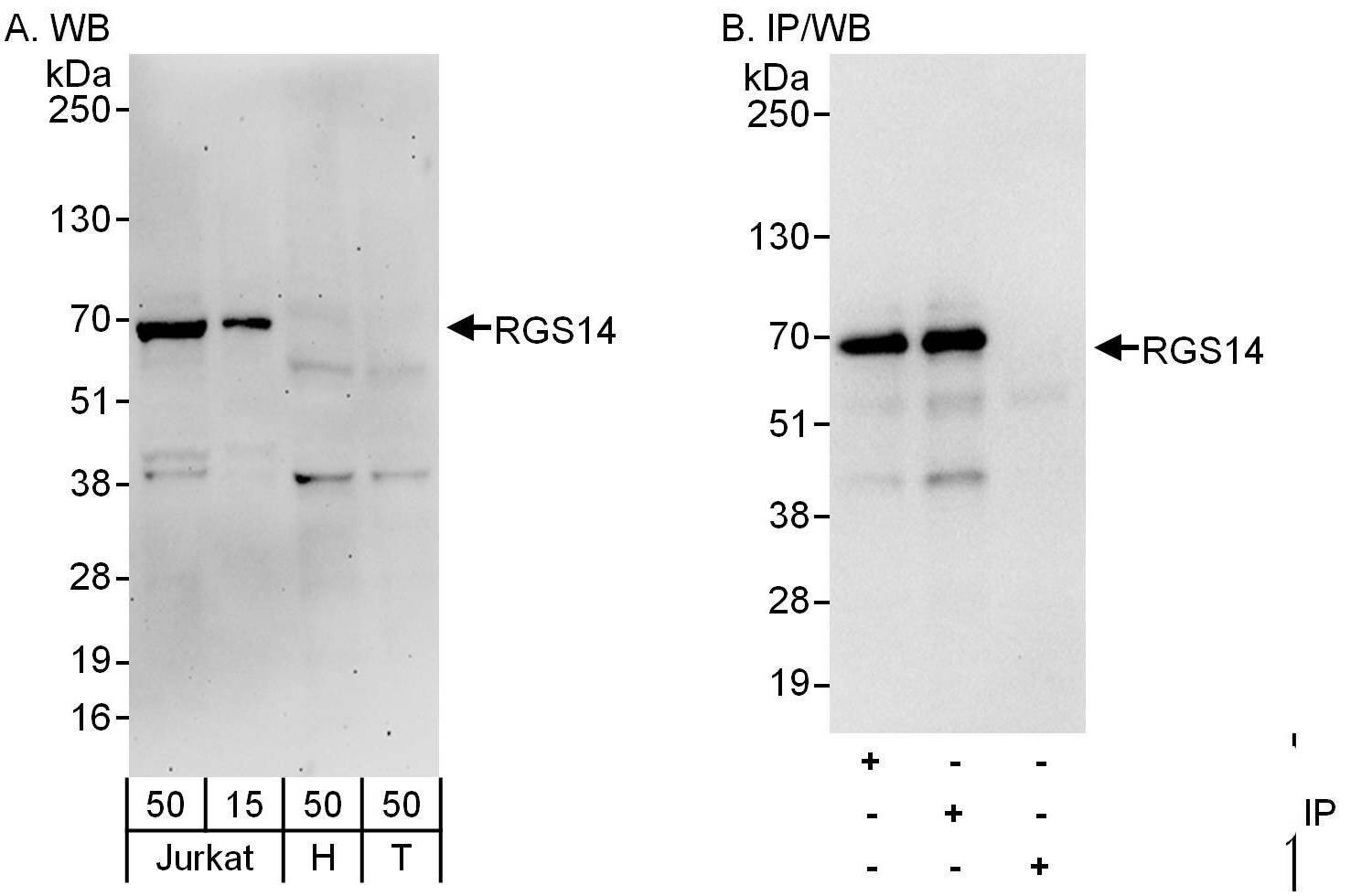 RGS14 Antibody