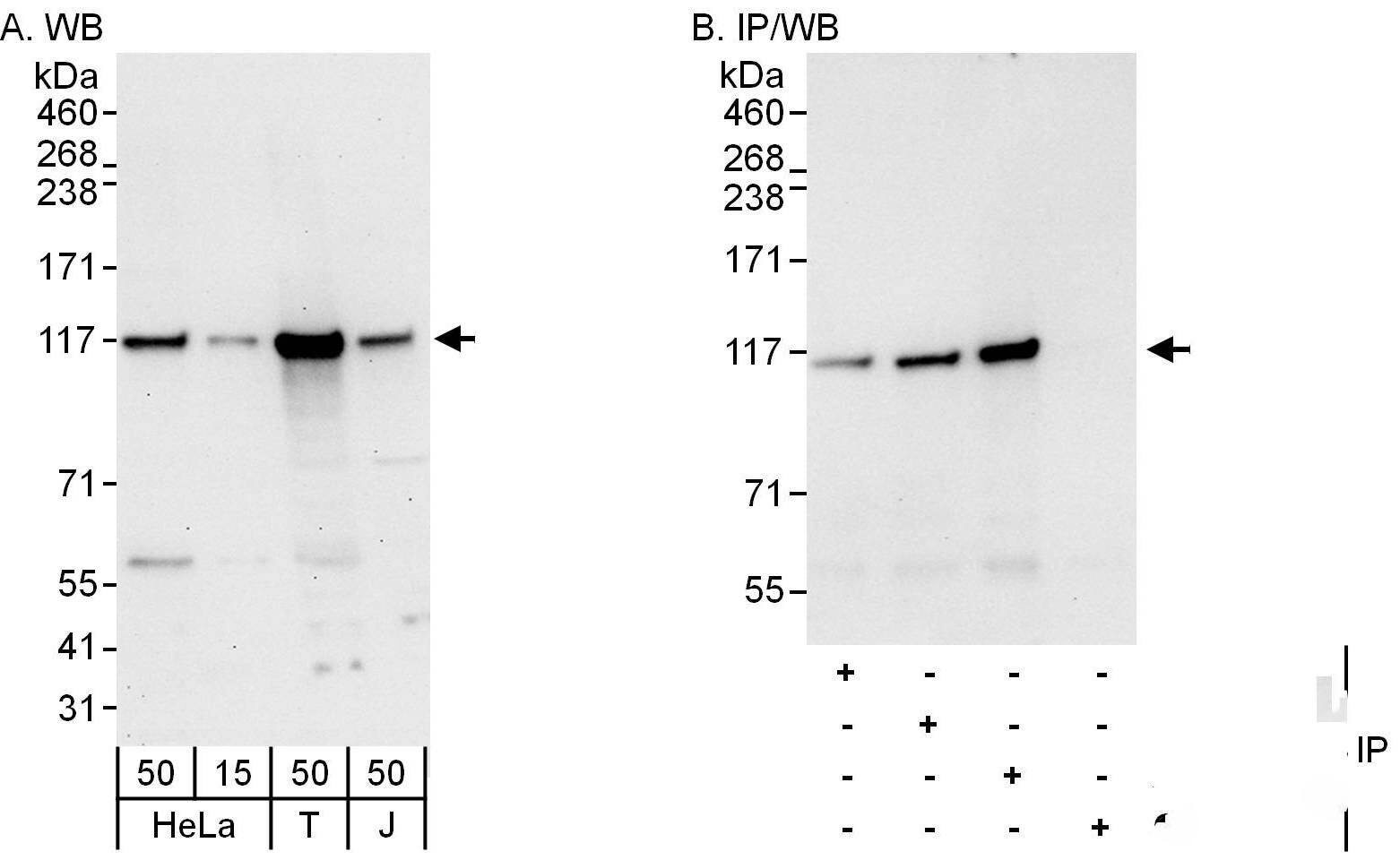 DIS3 Antibody