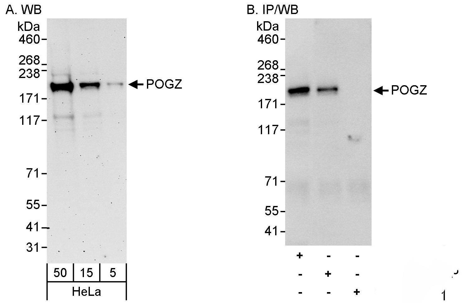 POGZ Antibody