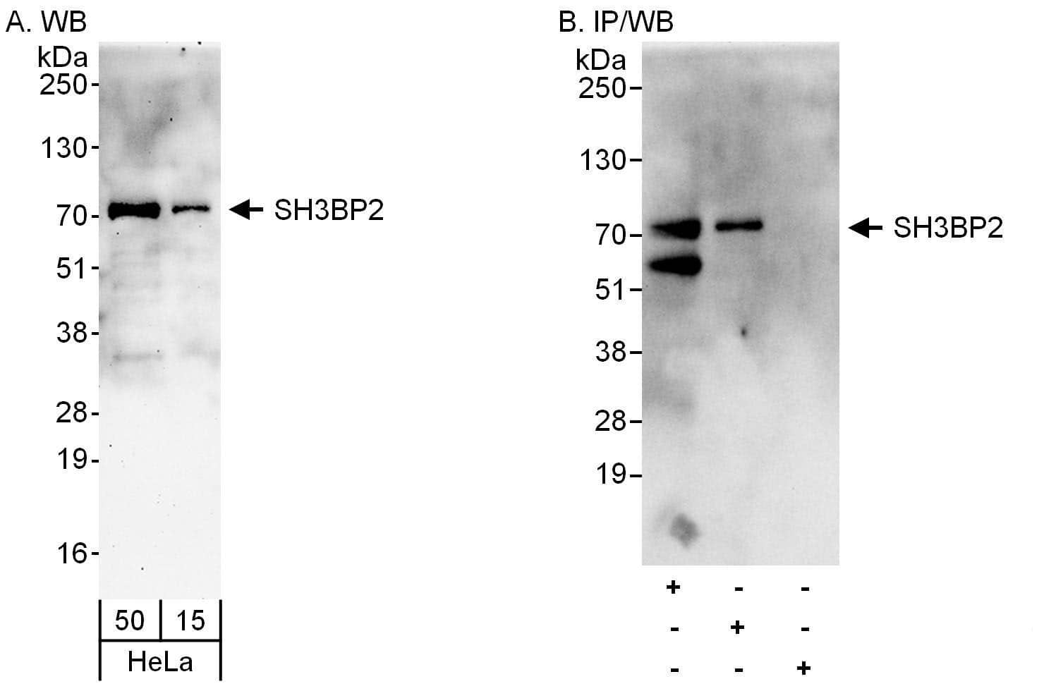 SH3BP2 Antibody