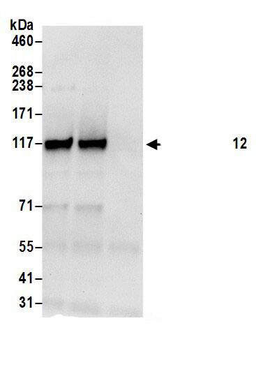 HIP1 Related Antibody