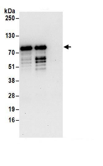 ZNF358 Antibody