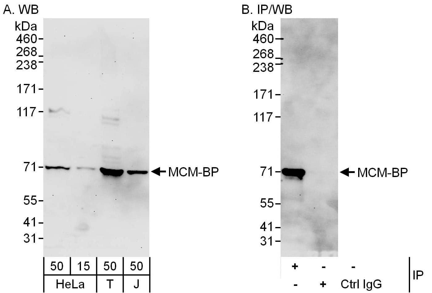 MCMBP Antibody