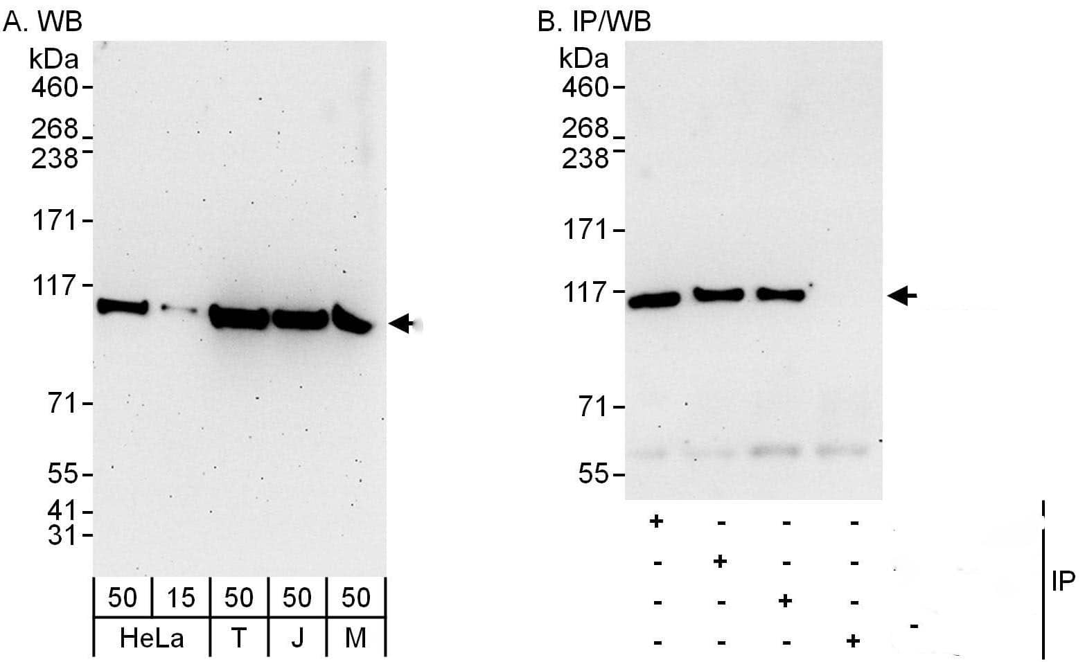 Alanyl tRNA synthetase Antibody