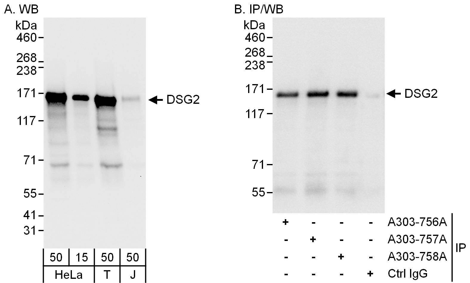 Desmoglein-2 Antibody