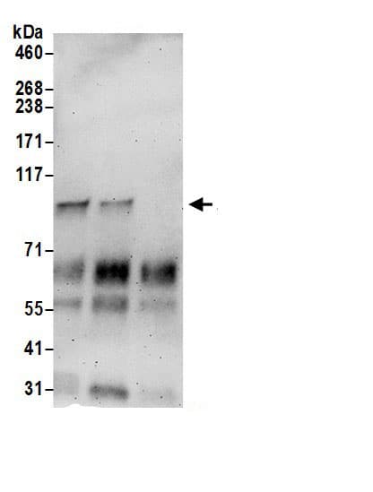 Importin 11 Antibody