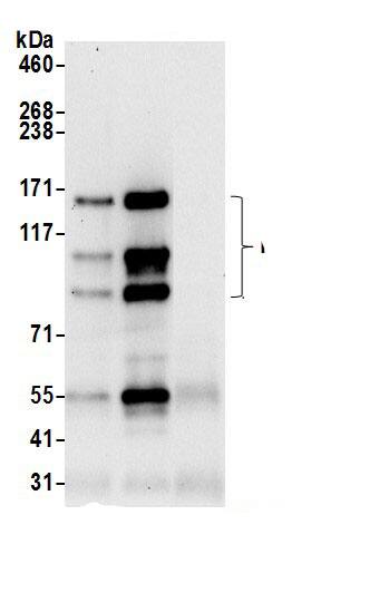 PLC-beta 3 Antibody