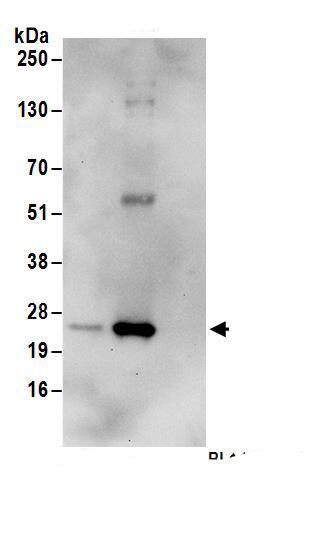 UBE2K/E2-25K Antibody