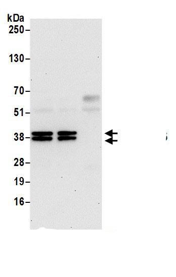 VTA1 Antibody