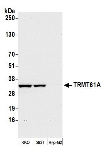 TRMT61A Antibody