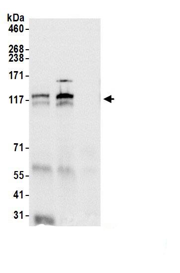 DNA Polymerase delta, catalytic subunit Antibody