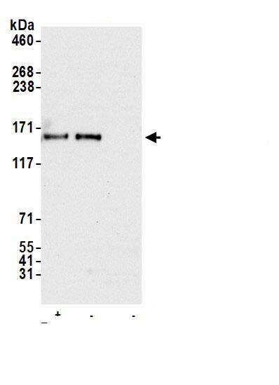 ORP150/HSP12A Antibody