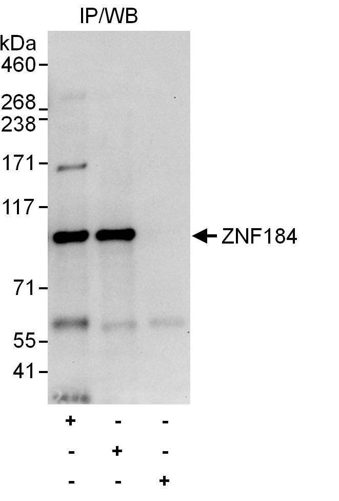 ZNF184 Antibody