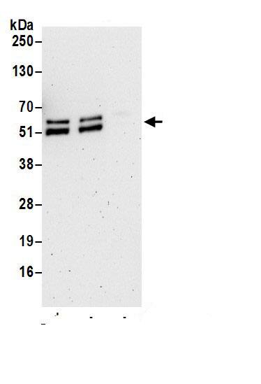 PPAR gamma/NR1C3 Antibody