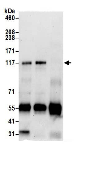 MSH3 Antibody