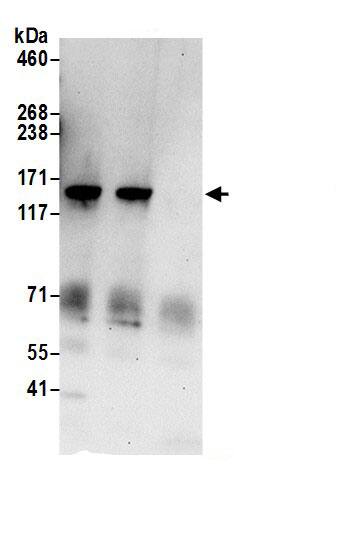 TBC1D9B Antibody