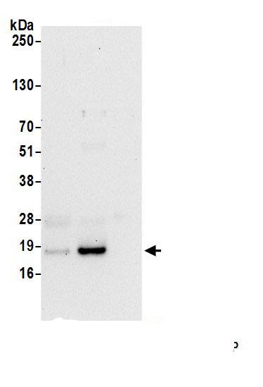 RPP20 Antibody