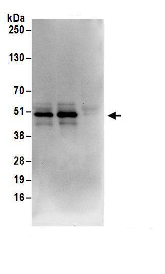 UFM1 Activating Enzyme/UBA5 Antibody