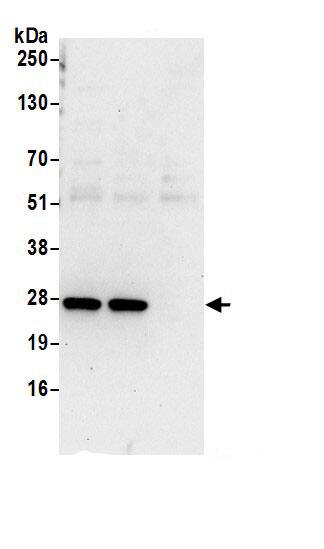 DTD1 Antibody