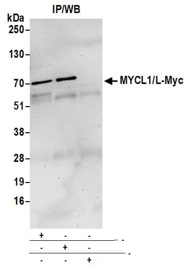 MYCL1/L-Myc Antibody