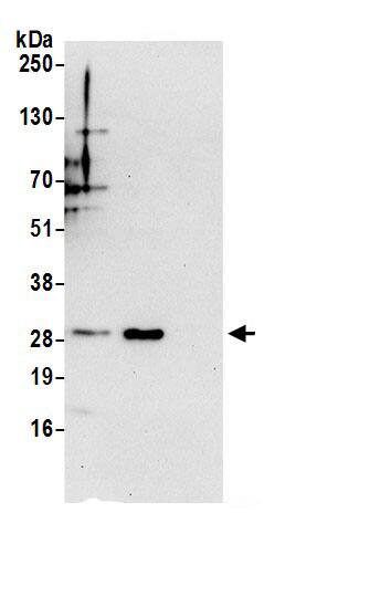 ETFB Antibody