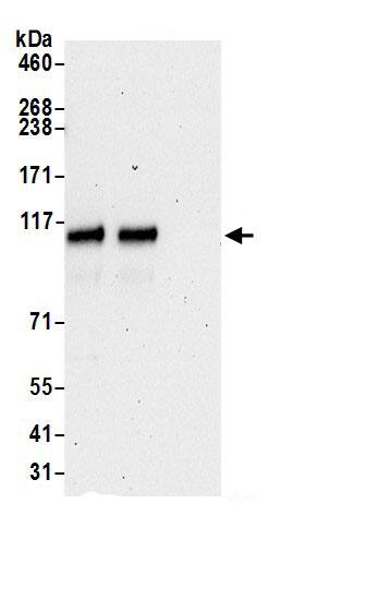 LIV-1/Zip6 Antibody