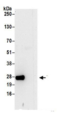 VBP1 Antibody