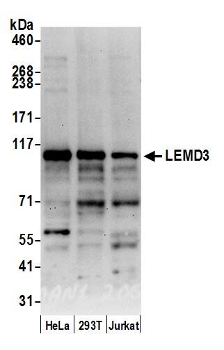 LEMD3 Antibody